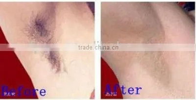 Cheap antique color touch screen ipl depilatory