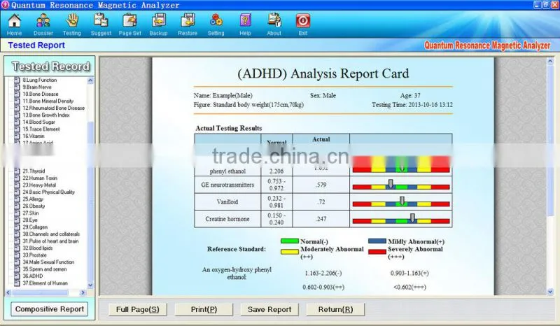 Alibaba in Spanish Quantum Magnetic Resonance Body Analyzer