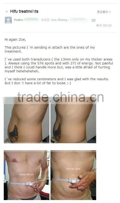 GLM Ultrasonic HIFU fat reduction HIFU body slimming