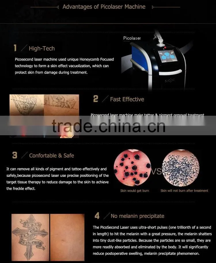 PicoSecond laser new laser for tattoo removal pigment removal