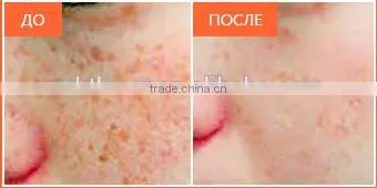 2016 Newest 2 handles OPT SHR IPL hair removal equipment/IPL SHR /3000W high power shr ipl machine