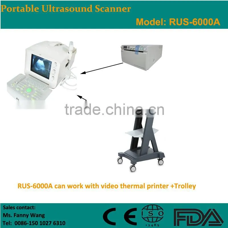 CE approved Portable B-Mode Ultrasound Scanner with 3.5Mhz multi-frequency convex probe RUS-6000A