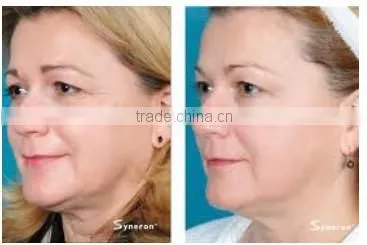 desktop/portable 633nm specific wave beam with vacuum and RF liposuction slimming machine(CE approved)