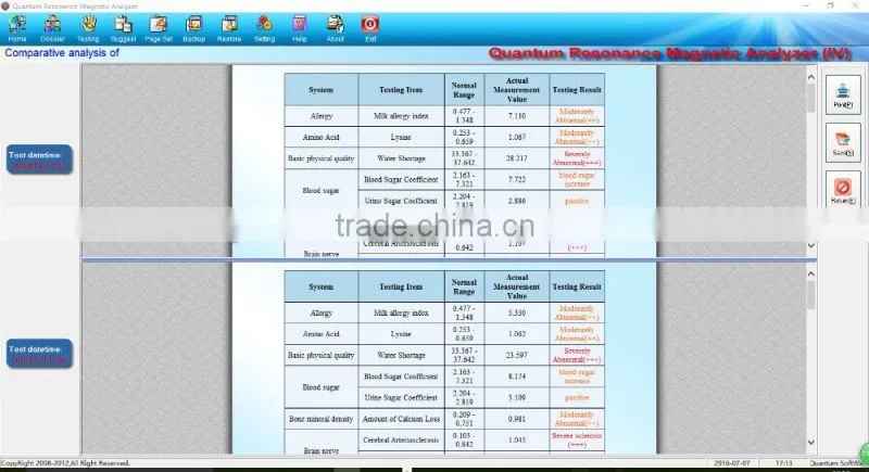 Factory price for Korea Original software 45 reports quantum resonance magnetic analyzer