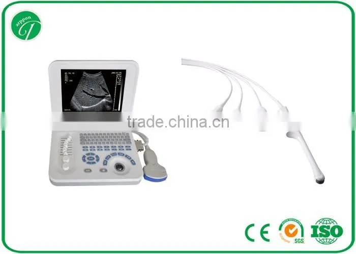 B Mode Laptop handled pregnancy Ultrasound Scanner Diagnosis