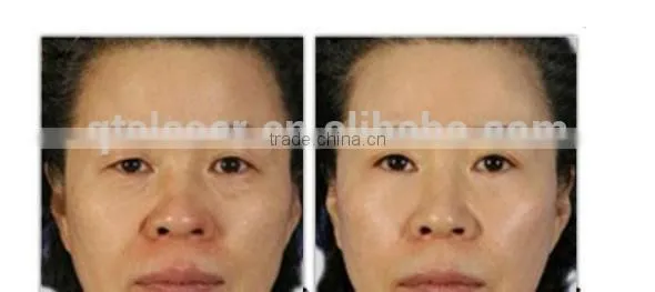 salon use RF Vacuum& cavitation slimming body beauty equipment