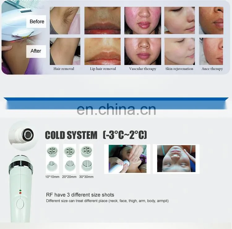 portable Opt RF Skin Care Hair Removal Rejuvenation Beauty machine factory price for sale