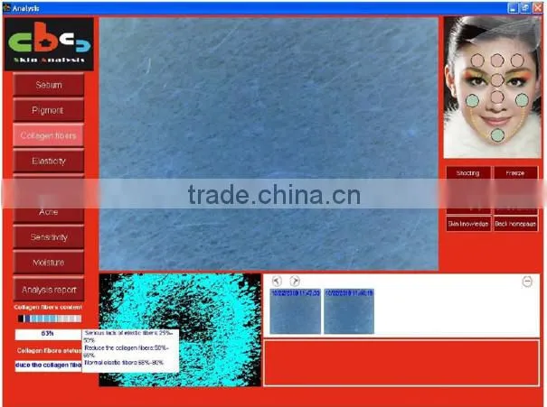 professional made in Taiwan skin magnifier portable skin analysis equipment