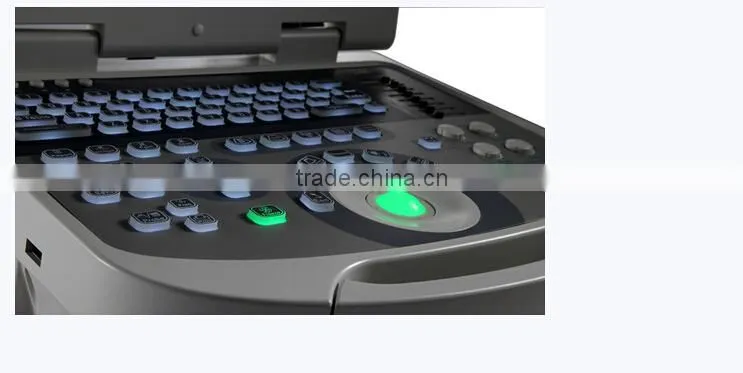 Medical Laptop B mode Ultrasound Scanner RUS-2200 USB 2.0 optional Biopsy Brackets