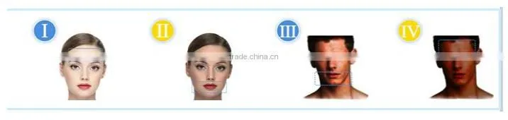 Hot sale portable 808nm diode laser hair removal machine/the best price