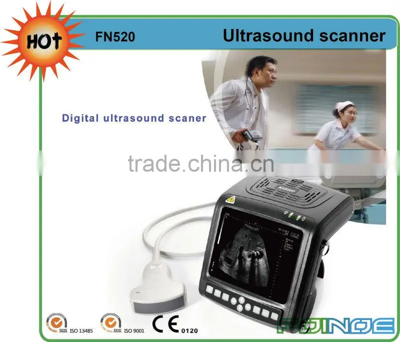 FN660 CE approved digital ultrasonic diagnostic imaging system