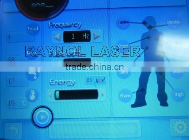 Color Touch Screen Hair Removal 808nm Laser Diode