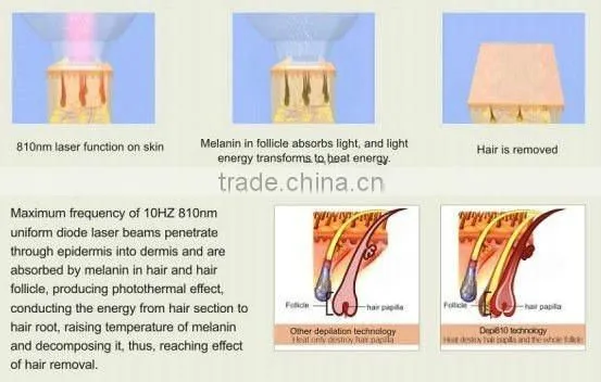Newly designed most advanced professional vertical 808nm diode laser hair removal skin spa medical apparatus