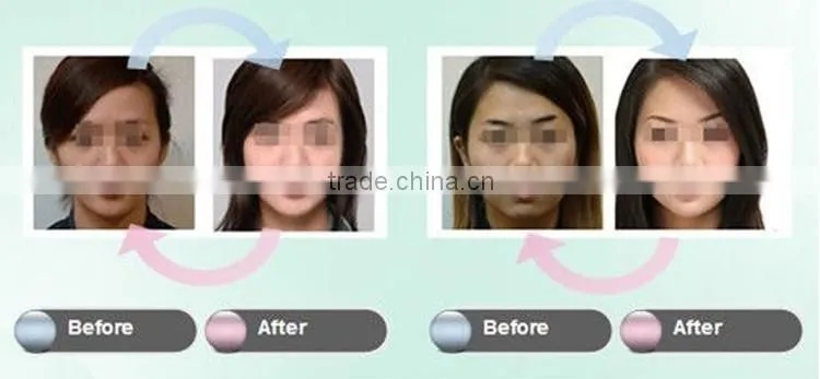 Hot Sale care aging how to use microneedle