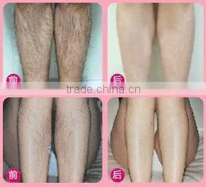 IPL Medical Beauty equipment