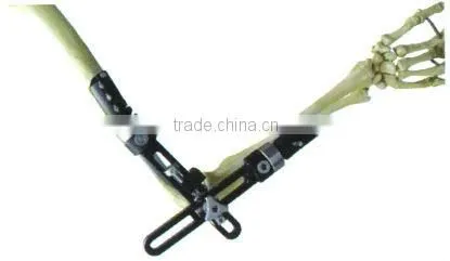 Elbow joint frame Bone Fracture External Fixation