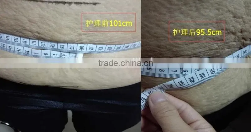 AYJ-S12 popular design high quality natural best way to lose belly fat hifu slimming machine