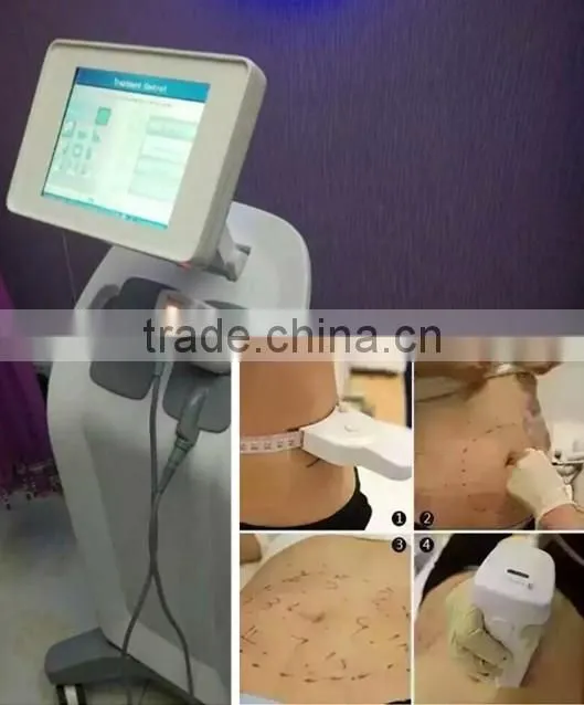 Professional Face Lift Hifu Ultra Slimming Machine With Liposonix