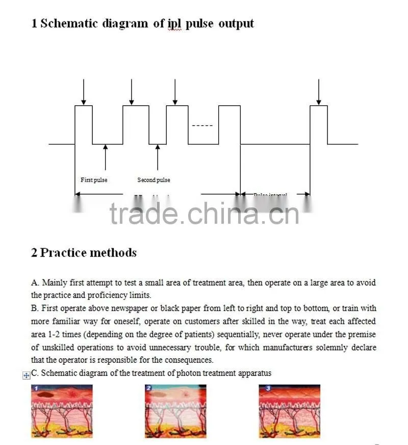 E-LIGHT Treatment High Quality Laser Tattoo Removal Machine