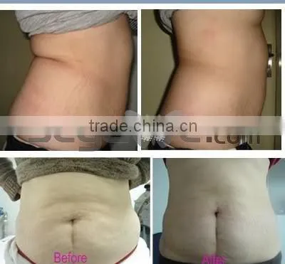 2014 hot selling cellulite remove weight ultrasonic cavitation vacuum slimming machine