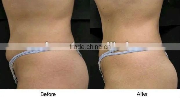 factory low price men body shaper weight loss equipment F019
