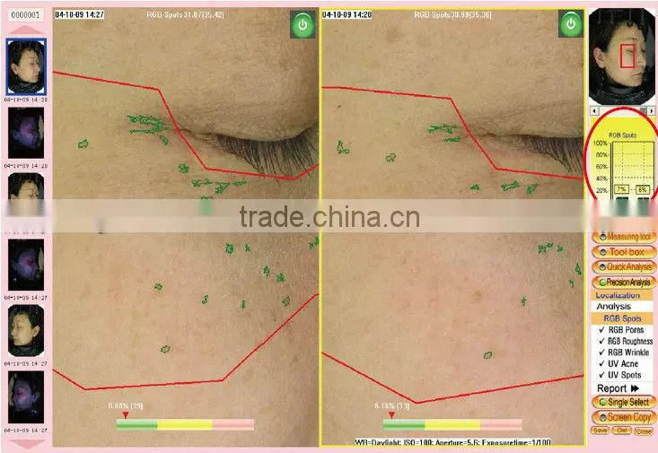 whole face testing skin analyzer magic mirror