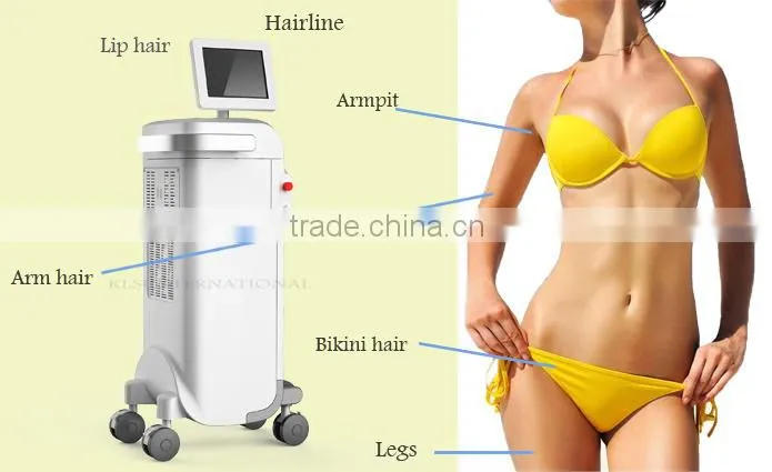 KLSi Hot Sale safe electric hair removal machine epilator