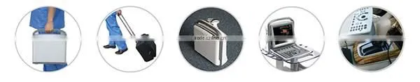 ECO2 high image quality good price black and white portable ultrasound Chison