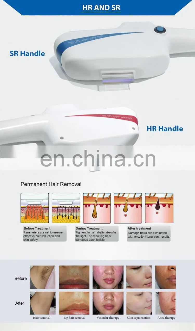 Beauty Salon / Clinic Use DPL OPT IPL Hair Removal / Princess DPL for Hair Removal skin rejuvenation