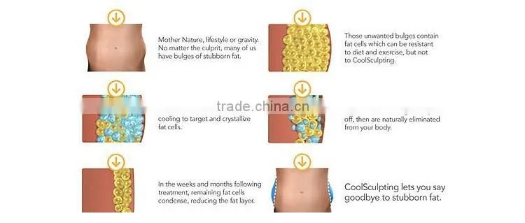 ultrasonic liposuction machine/non-invasive liposuction machine