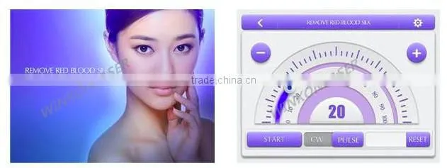 varicose veins / blood vessel spider vein treatment / spider vein spot removal machine