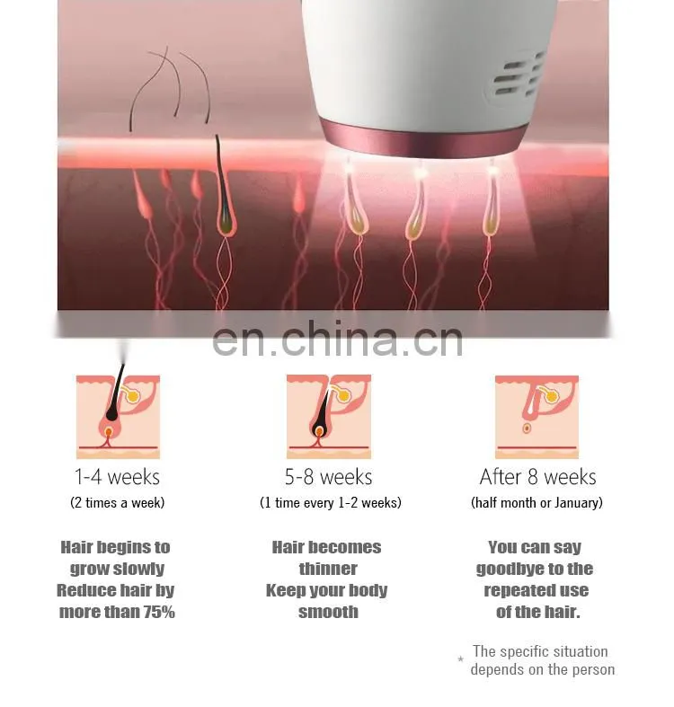 Professional Mini IPL Laser Hair Removal Device Diode Laser Machine Price Home Use