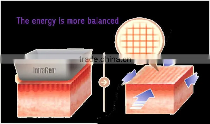 rf fractional hot and cold hammer for eyes face body