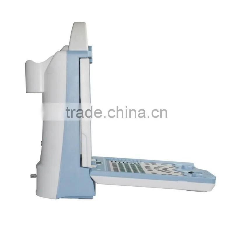 hospital Equipment laptop ultrasound machine/portable ultrasound scanner KX5600