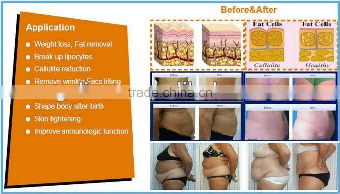 2013 Excellent+Fast+Promotion ultra cavi lipo machine(2-6cm size reduce /month, AMAZING RESULT!!)