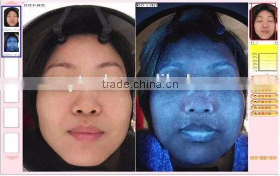 Professional 3D Camera skin diagnosis scanner skin magic mirror 3D system skin analyzer machine A10