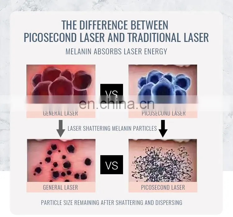 Picosecond 1064 nm 755nm 532nm Pico q switched Nd Yag Laser Pico Laser Tattoo Removal skin whitening remove freckle machine