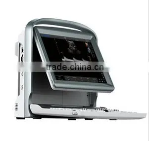 2016 NEW ultrasound scanner Color doppler