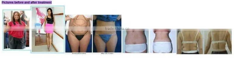2014 most popular! ultrasound cavitation /cavitation rf/ body slimming machine