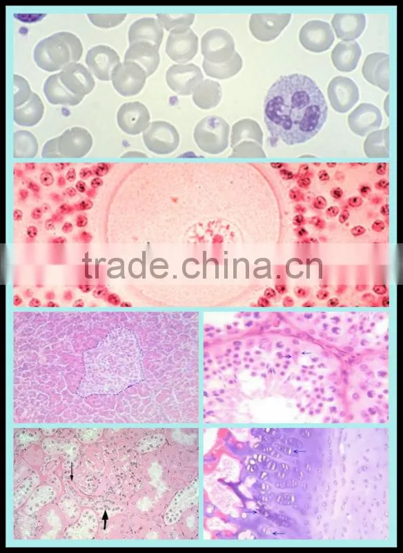 hemopathy prepared microscope glass slides for teaching and lab survey