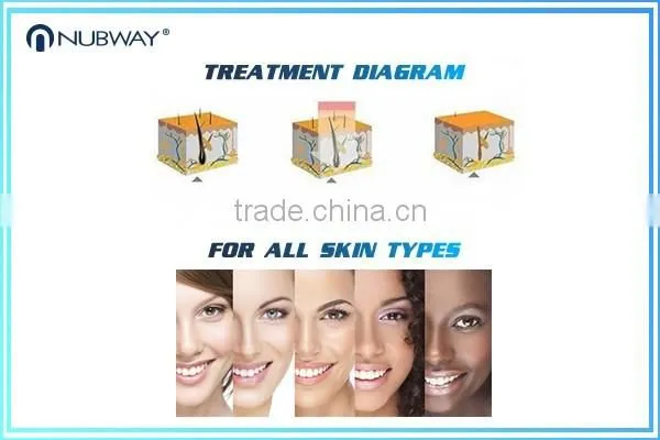 Salon beauty equipment latest products in market diode hair removal laser