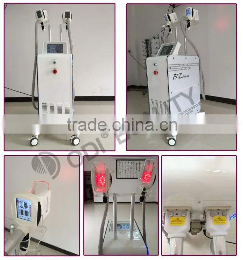 OD-C100 OEM body weight loss Fat Freezing belly fat loss slimming equipment