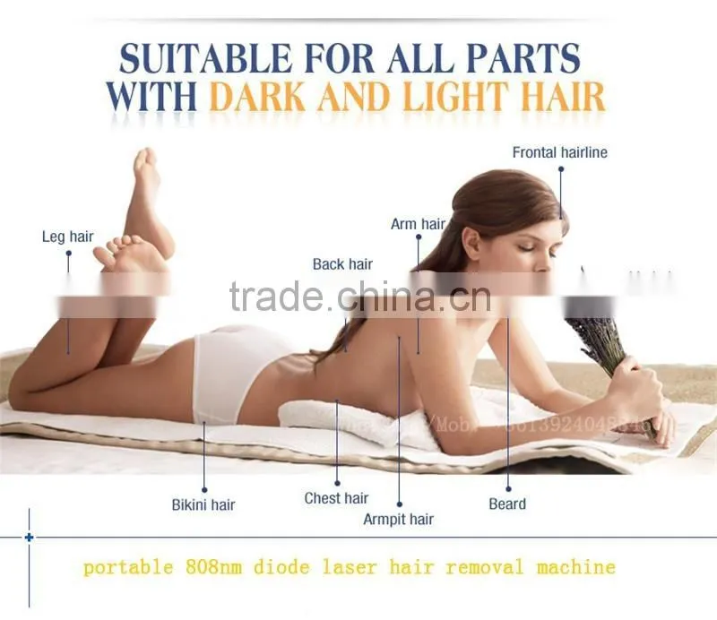 cheap portable 808nm laser diode/808nm/laser hair removal machine