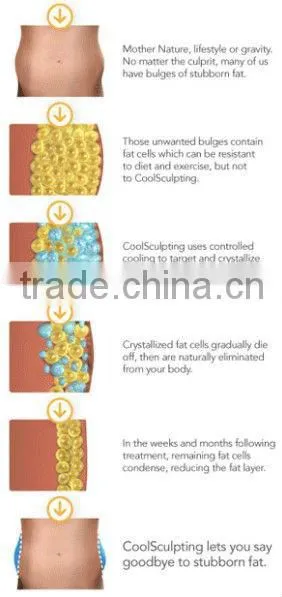 2016 Antifreeze Membrane For cryotherapy slimming