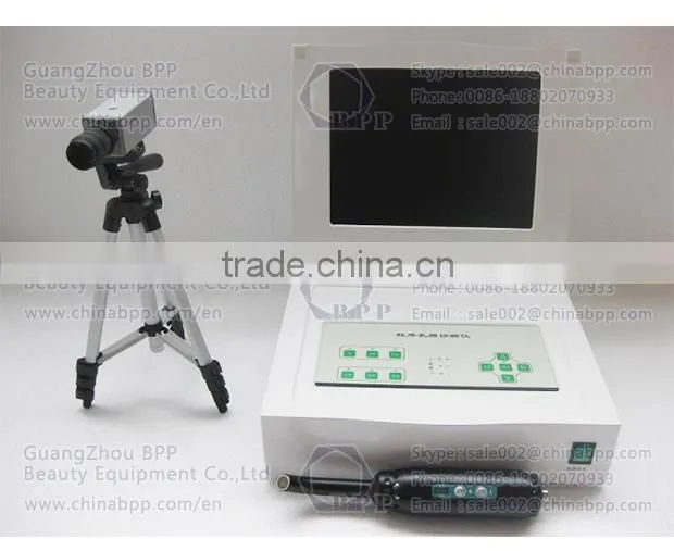 Infrared Mammary Gland Diseases Detector Women Breast Biopsy Analyzer Machine