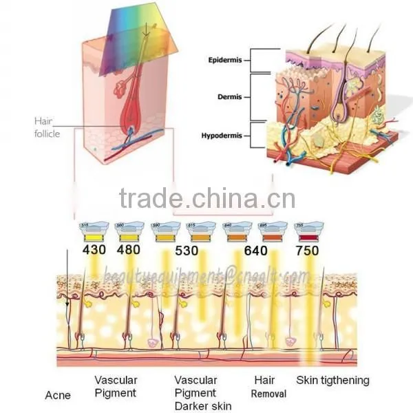 Ipl hair removal new technology product in chin