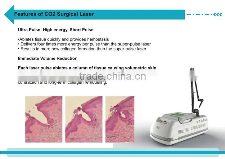 portable RF drive fractional freckle wrinkle acne scar removal whiting CO2 fractional laser machine -CV-II