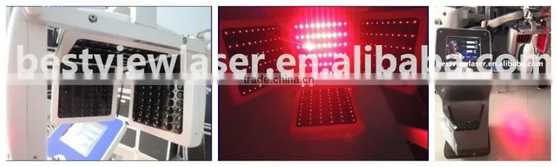 Machine laser hair treatment for hair growth BM-666