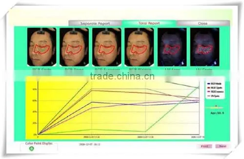 CE approved boxy skin & hair analyser