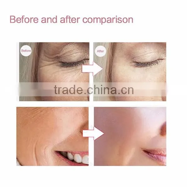 EYCO facial light therapy devices acne blue light therapy red light therapy for face mask